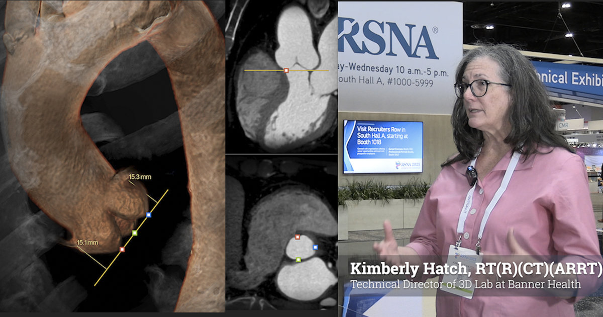 Leveraging IT and AI to transform 3D imaging lab workflows at Banner Health