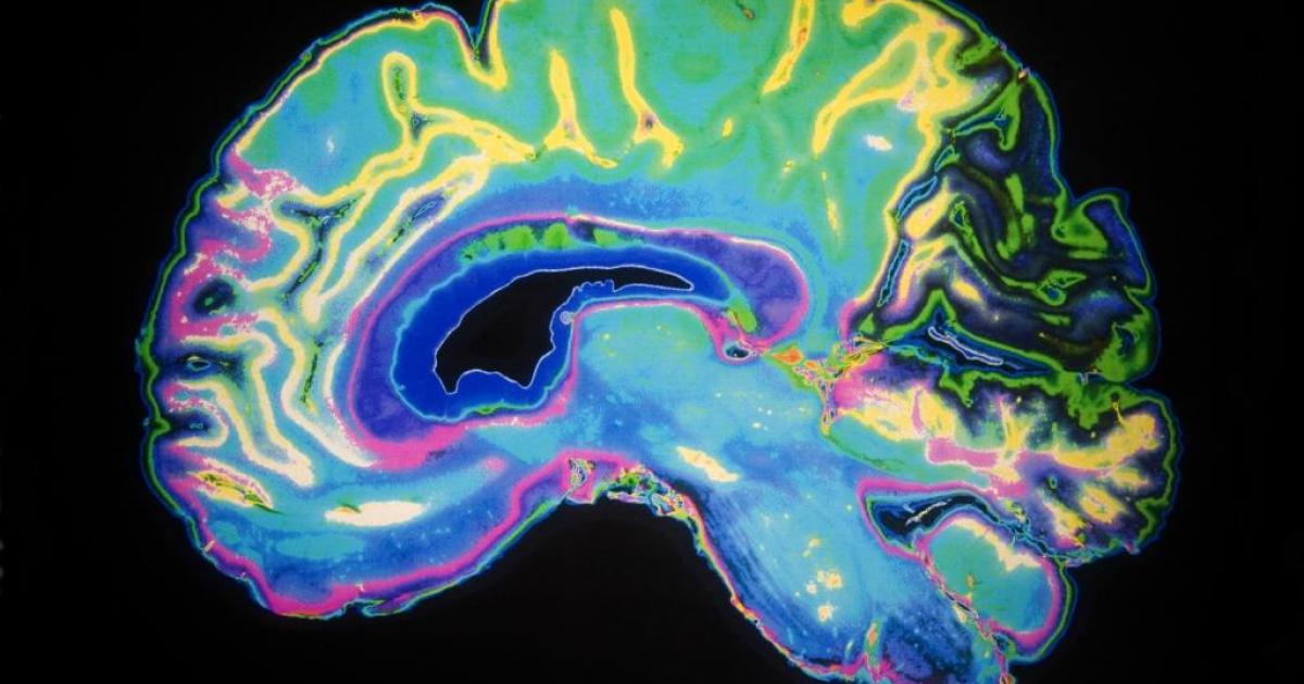 Biologiczny „wiek mózgu” może pomóc utorować drogę bardziej spersonalizowanej medycynie
