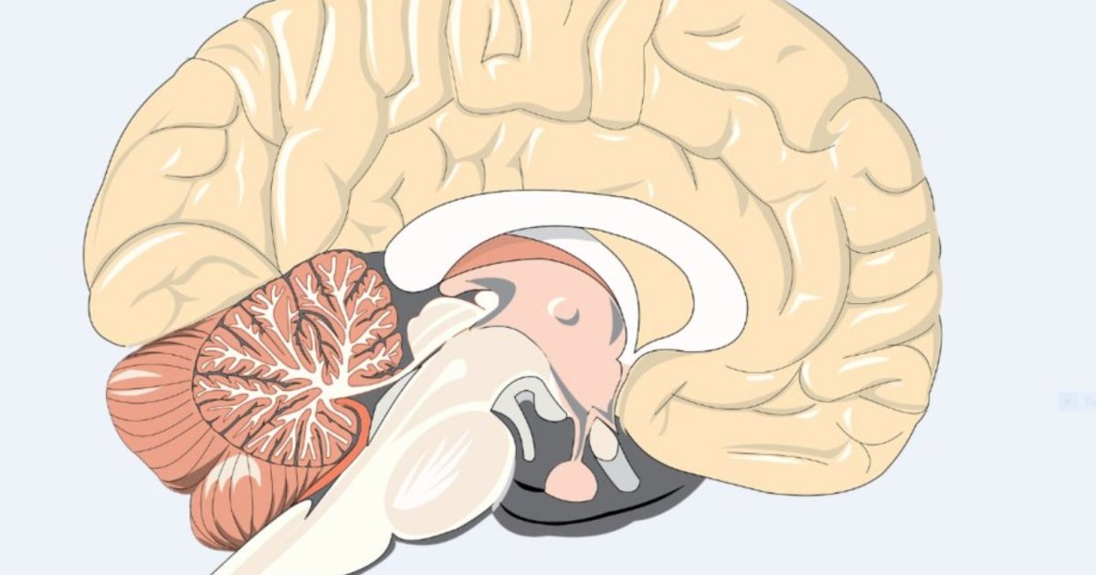 How helpful is MRI for diagnosing a concussion?