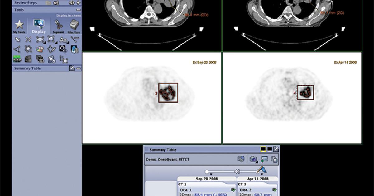 Strengths, Struggles & Strategies Managing Image Data