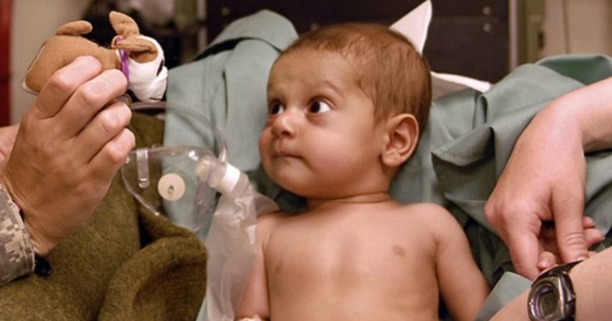 Tracking plus feedback plus training add up to halved rad doses in kids