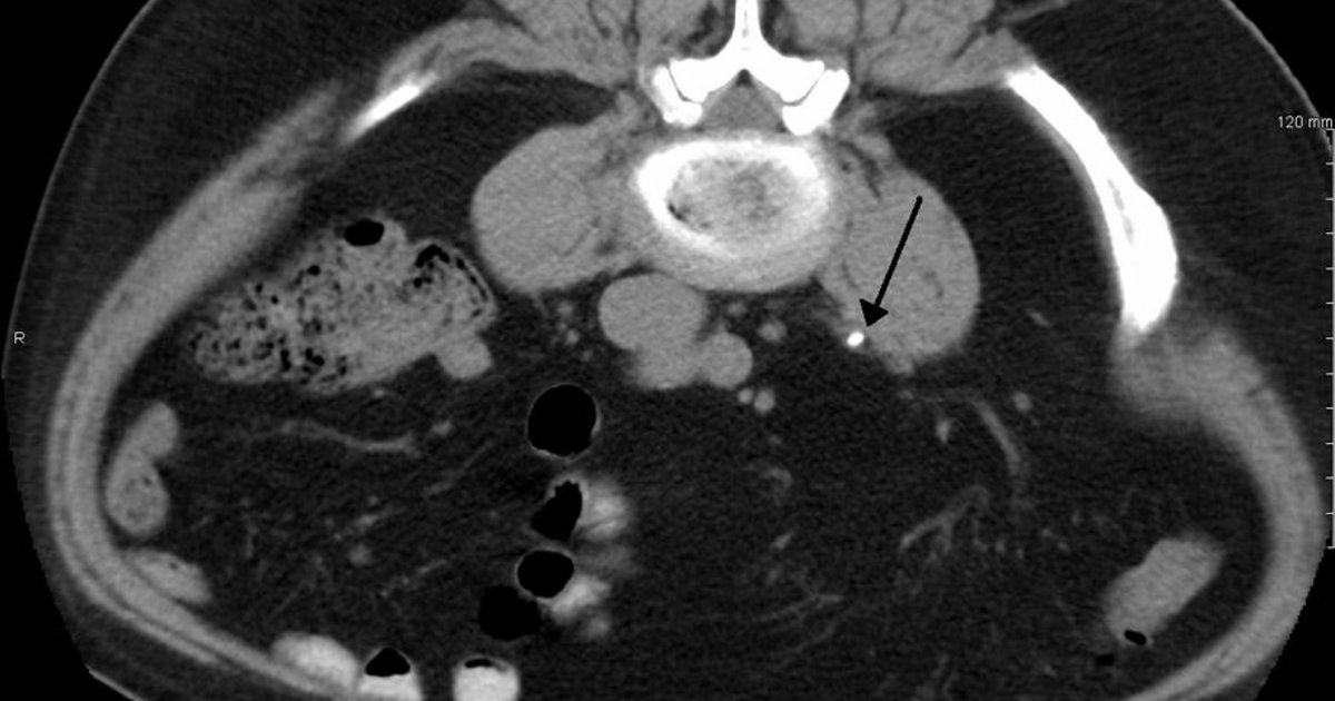 CT with hugely reduced radiation capable of calling up appropriate ...