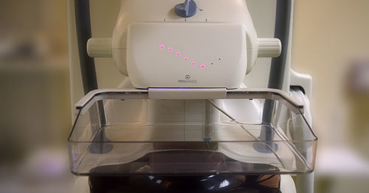 RSNA: New device, compression protocol could ease mammo pain