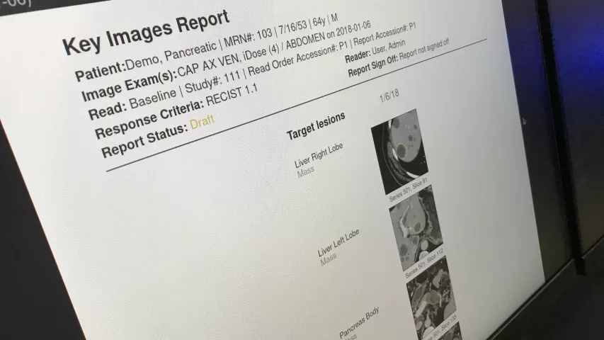 Example of AI pulling key images for thumbnails in a CT dataset for display to make it easier for radiologists to visually fine what they are looking for rather than reading a long list of text descriptions. Example shown by AI Metrics.