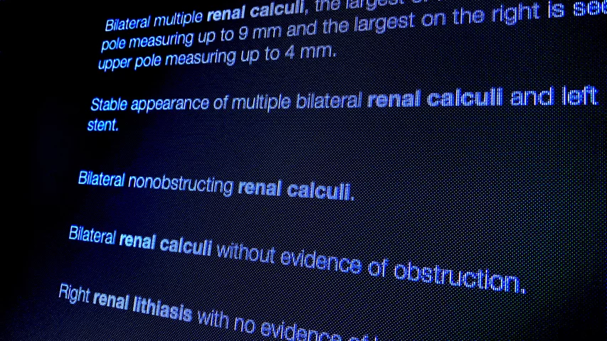 Data analytics pulling all content with term renal calculi emtelligent HIMSS23.