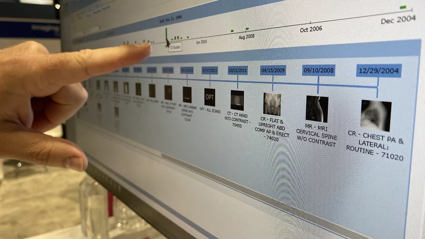 Enterprise Imaging PACS thumb nail images on a patient timeline shown by Agfa at HIMSS 2023. Photo by Dave Fornell