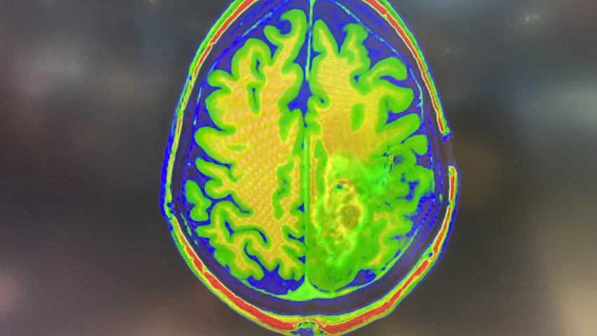 Brain MRI, from Sectra PACS, HIMSS 2023.
