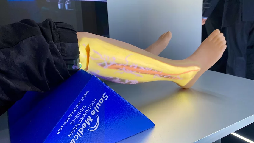 AI automated registration on medical imaging projected onto the patient's skin so surgical planning and marking the patient. Shown as a work in progress by United Imaging at RSNA 2023. Photo by Dave Fornell. #RSNA #RSNA23 #RSNA2023 orthopedic imaging
