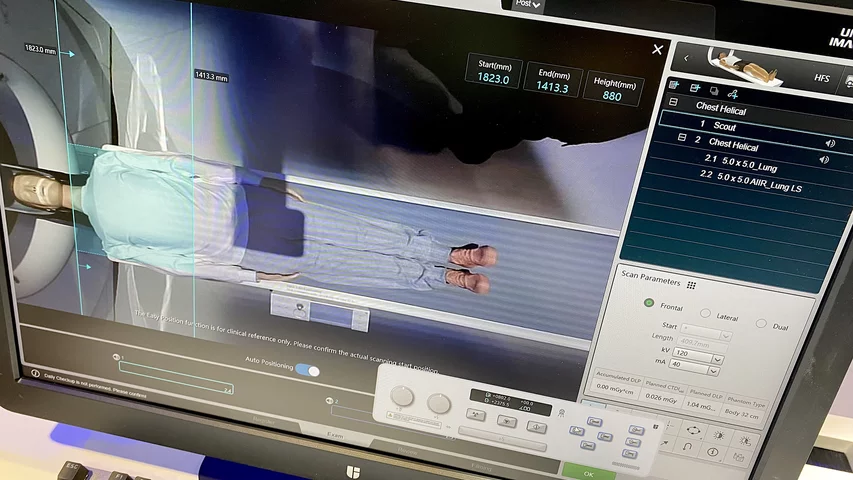 Automated AI isocentering of patient with overhead camera on United Imaging uCT Atlas scanner. Photo by Dave Fornell. #RSNA #RSNA23 #RSNA2023 orthopedic imaging