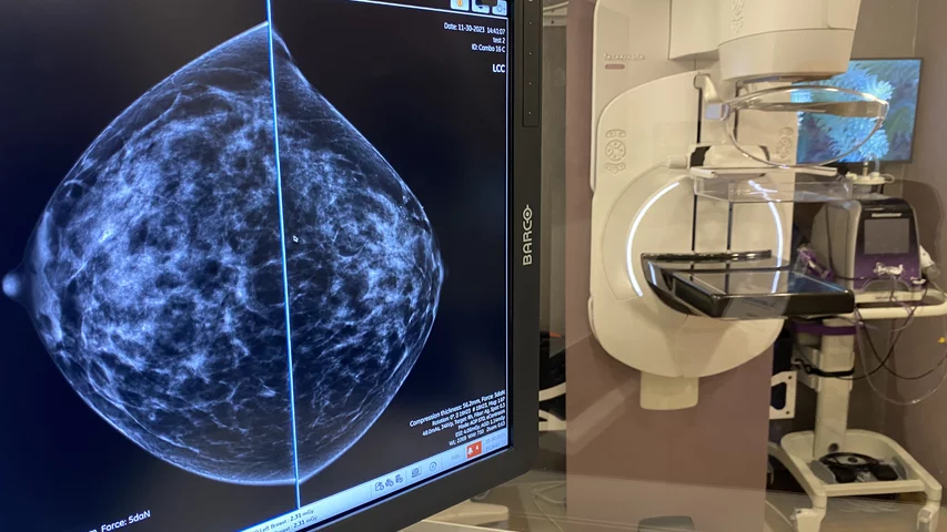 Breast tomosythesis (3D mammography) mobile clinical install of the GE Senograph Pristina in a truck on display at RSNA 2023. Photo by Dave Fornell. #RSNA #RSNA23 #RSNA2023 #3Dmammo #3Dmammography