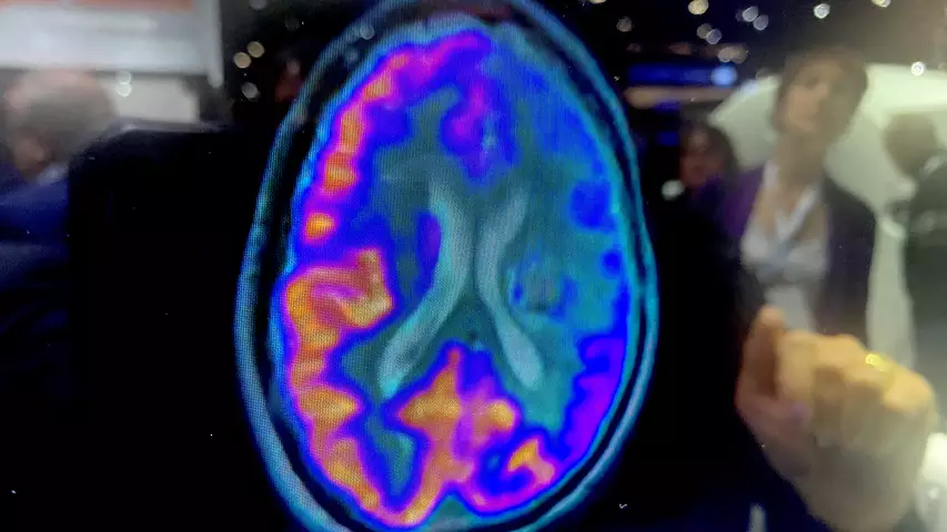 【美品・電子版使用済】Diagnostic Imaging: Brain 脳画像 PHOTO GALLERY of brain imaging