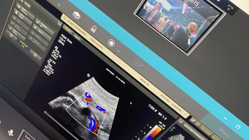 Example of remote access technology where a more experience sonographer from another location can remote in to see the settings and imaging on the system to help trouble shoot, or a physician can do remote consultations. Photo by Dave Fornell #RSNA #RSNA23 #RSNA2023