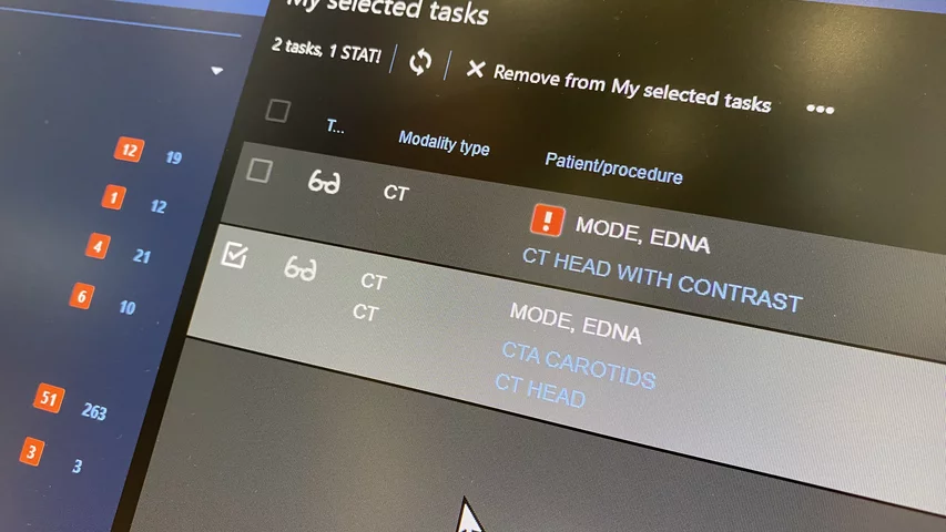 Stat reading list view on the Agfa AI orchestrated workflow radiology work list. Photo by Dave Fornell #RSNA $RSNA2023 #RSNA23
