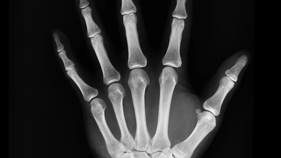 hand x-ray radiograph
