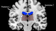 fMRI from Georgia Tech