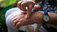 Arthritis
