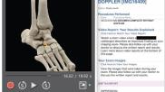 Examples of a radiology report embedded video and text explaining the video for the patient in the report. This is from an AJR study that found embedding short videos from the radiologist explaining the images greatly enhanced patient engagement and satisfaction.