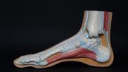 Foot ultrasound bested foot MRI on pooled sensitivity while lagging on specificity