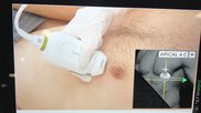 Novice medical professionals perform diagnostic quality echocardiograms with AI guidance 
