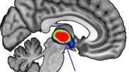 thalamus