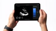 GE healthcare has purchased Caption Health. This added cardiac ultrasound AI guidenance to GE's echocardiogram systems so even inexperienced sonographers and point of care ultrasound (POCUS) users will be able to obtain high-quality echo exams.