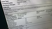 Carotid artery Cath lab report CVIS interventional reporting Fujifilm HIMS23.