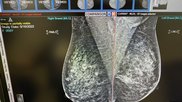 Mammography reading workstation at Sectra booth HIMSS23.