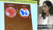 Roosha Parikh, MD, advanced imaging cardiologist, St. Francis Heart Hospital, Long Island, New York, and a clinical assistant professor of medicine at the State University of New York at Stony Brook, presented in one of the ASE 2023 amyloid sessions and spoke with Cardiovascular Business about the disease. Example of cardiac ultrasound strain imaging for cardiac amyloidosis. 