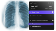 medical imaging exam annalise.ai