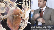 Mark Rabbat, MD, director of cardica CT at Loyola, discusses legislative advocacy efforts by SCCT to gain wider reimbursement for cardiac CT. #SCCT #SCCT23 #SCCT2023