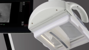 GE HealthCare launches AI-enabled automated breast ultrasound system