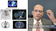 Prem Soman, MD, PhD, FACC, FRCP, past president of the American Society of Nuclear Cardiology (ASNC), the Richard S. Caligiuri Endowed Chair in Amyloidosis and Heart Failure, director of the Cardiac Amyloidosis Center, director of nuclear cardiology, and a professor of medicine, University of Pittsburgh Medical Center (UPMC) Heart and Vascular Institute. He is presenting the keynote Mario Verani Memorial Lecture at ASNC 2025, where he will discuss transforming cardiac amyloidosis care.