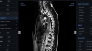 Shopify CEO says he created his own MRI viewer with AI