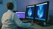 mammography lunit 