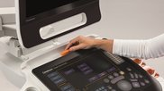 Carestream Touch Prime Ultrasound