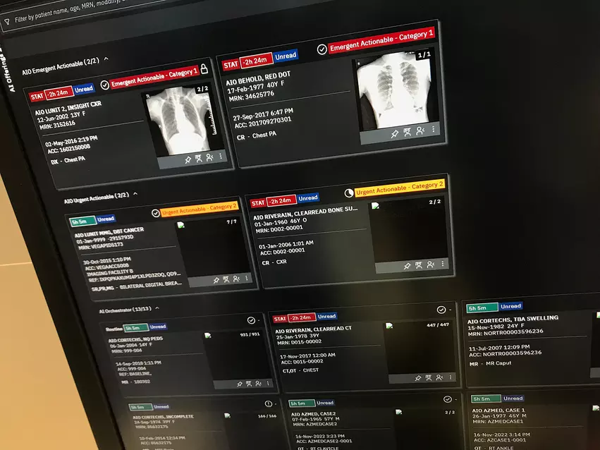Example of actionable results color coded in red based on automated AI assessment of a study so it if flagged for closer review by a radiologist. Example from the Merge PACS.