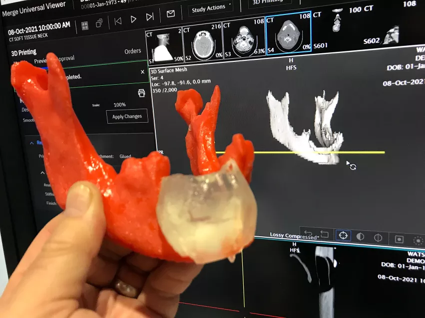Printer company Ricoh 3D has launched a 3D printing service for healthcare where radiologists or surgeons can take CT scans and create 3D print files that can then be uploaded online and a medical-grade print project is returned to the hospital within a week. 