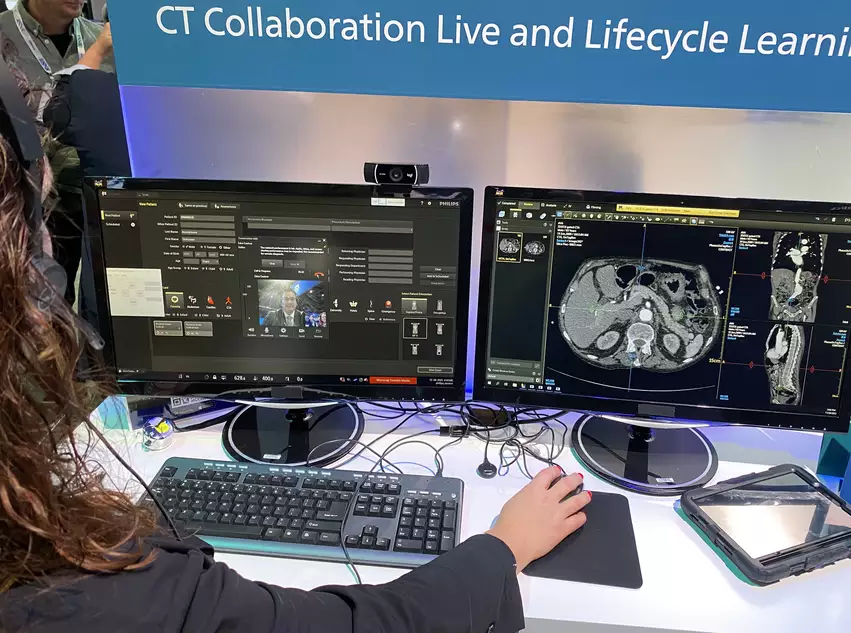 Philips launched the CT collaborative remote access technology for technologists and radiologists to remote into CT system control rooms to help troubleshoot, even if they are not at the same imaging center. Photo by Dave Fornell. #RSNA #RSNA23 #RSNA2023