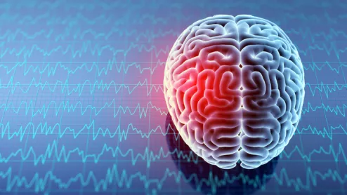 Concussion brain Concussion brain