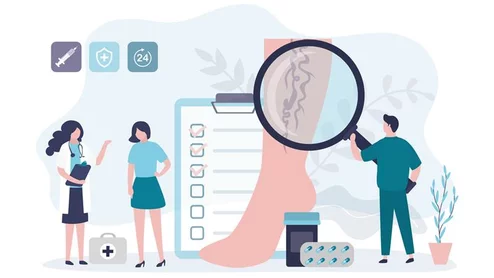 leg veins chronic venous disease PAD peripheral artery disease