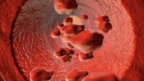 Radiogel's IDE denied