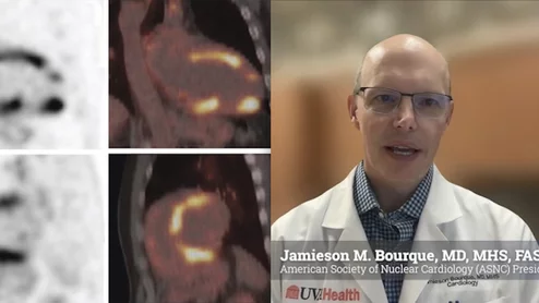 American Society of Nuclear Cardiology (ASNC) President-elect Jamieson M. Bourque, MD, MHS, FASNC, medical director of nuclear cardiology, echocardiography, and the stress laboratory at UVA Health in Charlottesville, and a professor of medicine and radiology at the University of Virginia, explains key trends and his plans to advance nuclear cardiology in 2026. #ASNC