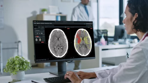 Brainomix 360 triples number of stroke patients who regain functional independence.