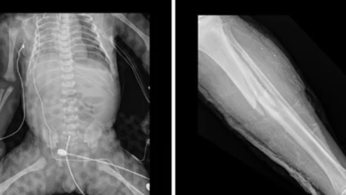 Radiology providers from Israel share how their hospital handled the mass casualties caused by the October 2023 terror attacks.