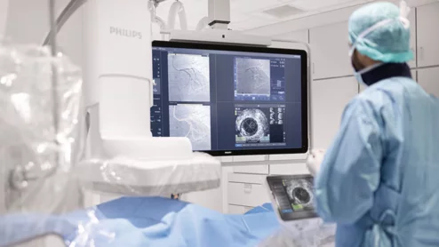 Philips agrees to acquire vascular imaging specialists SpectraWAVE