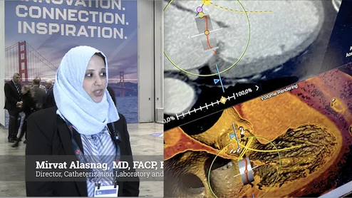 Mirvat Alasnag, MD, FACP, FACC, FSCAI, FSCCT, director of catheterization laboratory and research, King Fahd Armed Forces Hospital, Jeddah-Saudi Arabia, director of TCT Middle East, and member of Society of Cardiovascular CT (SCCT) Education Committee, outlines why coronary CT angiography (CCTA) imaging will likely be a paradigm shift in cardiology, and where the gaps remain to gather more clinical evidence. 