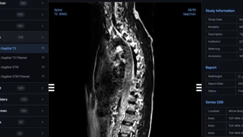 Shopify CEO says he created his own MRI viewer with AI