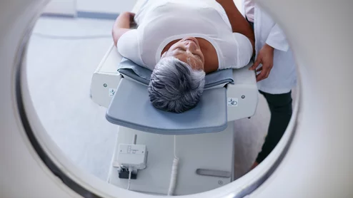 brain alzheimers pet scan drug CT dementia