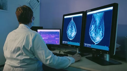mammography lunit
