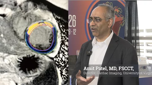 Amit Patel, MD, FSCCT, secretary of the Society for Cardiovascular Magnetic Resonance (SCMR), director of cardiac imaging and professor of medicine at the University of Virginia Health System in Charlottesville, outlined four key areas where cardiac MRI is expanding its clinical value, along with the growing role of artificial intelligence (AI) in making advanced imaging techniques more practical for routine clinical use. #CMR #SCMR #CardiacMR